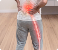 Sciatica-Type Symptoms