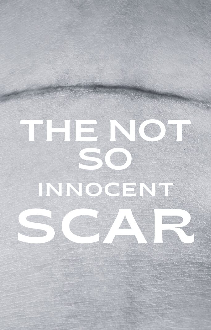 The Not So Innocent Scar